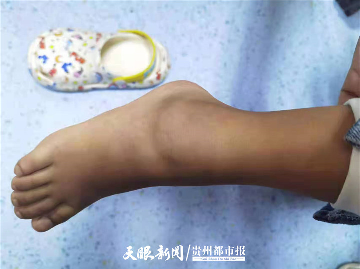 12岁小孩风湿关节炎,儿童医院风湿免疫科好吗