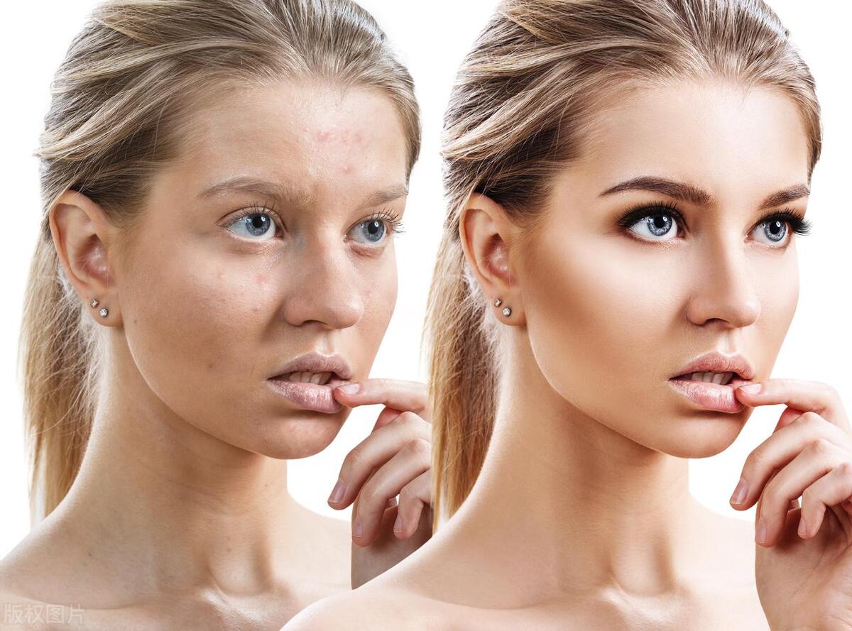 哪款祛疤药最好用,祛疤药膏排名前十位