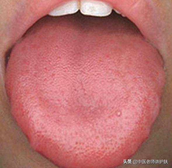 色斑也得分类别,从中医角度浅谈色斑成因,这样治疗更有效