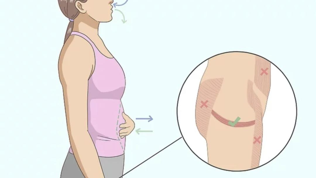 40岁盆底松弛漏尿凯格尔运动,盆底松弛凯格尔运动有效果吗