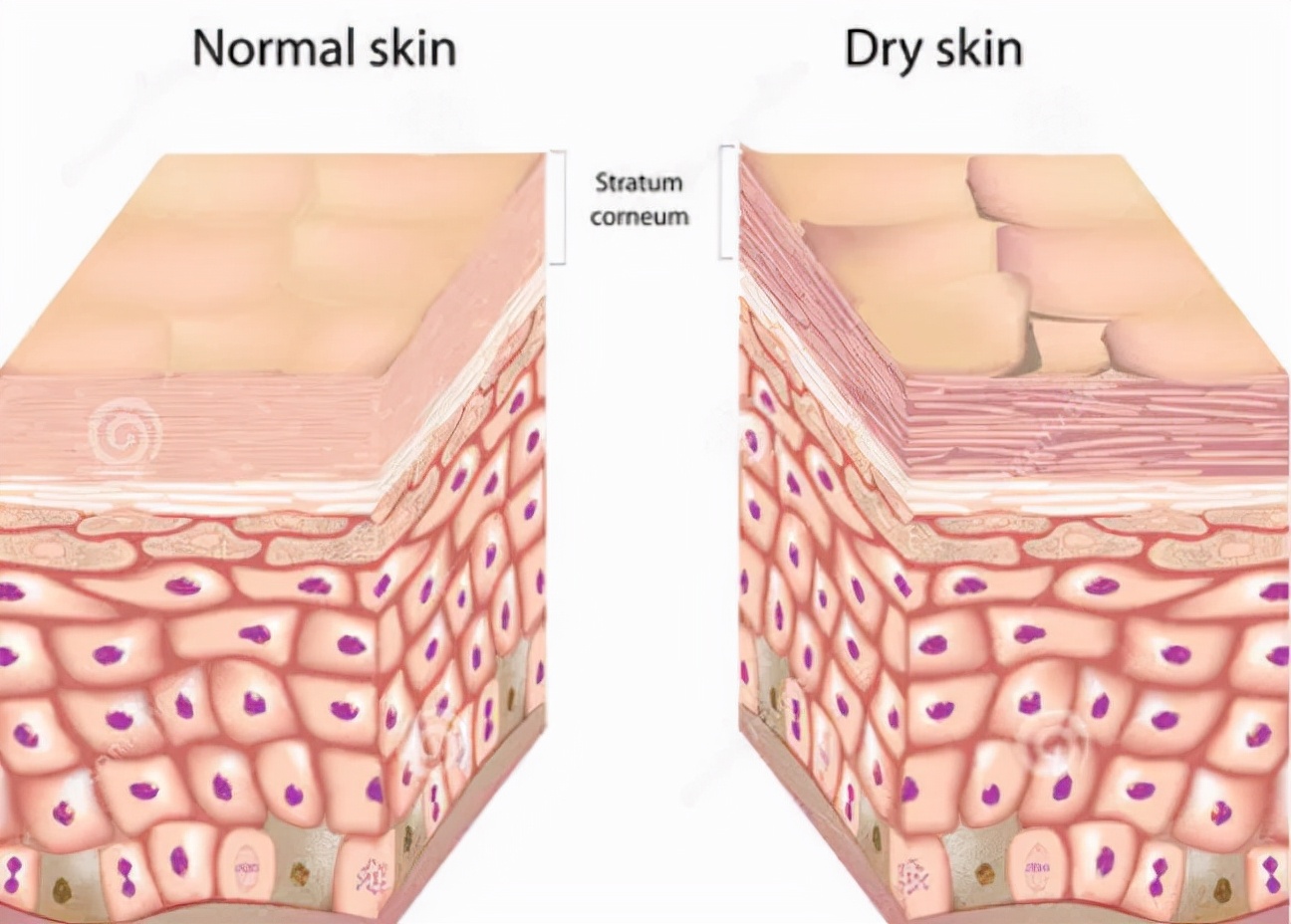护肤毁脸的十大误区,护肤烂脸