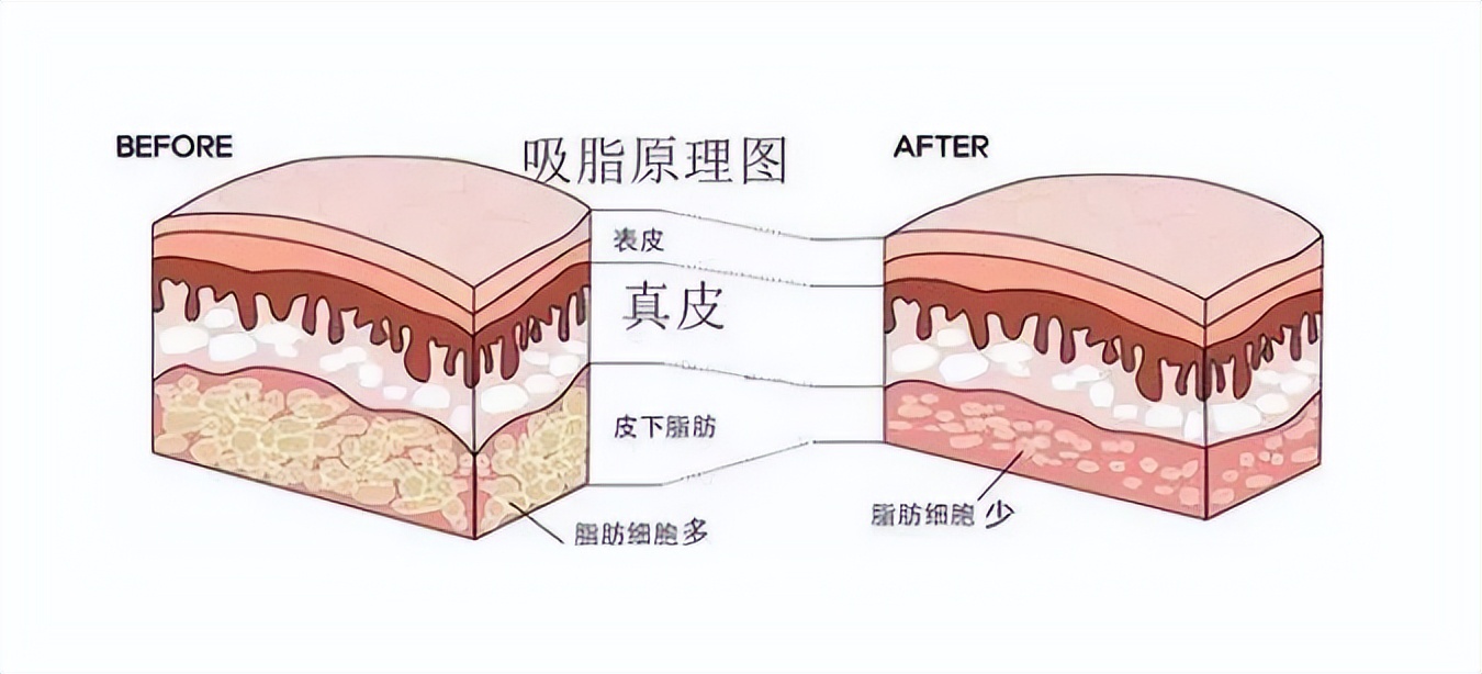 闈㈤儴鍚歌剛闊︽晱,闊︽晱闈㈤儴鍚歌剛