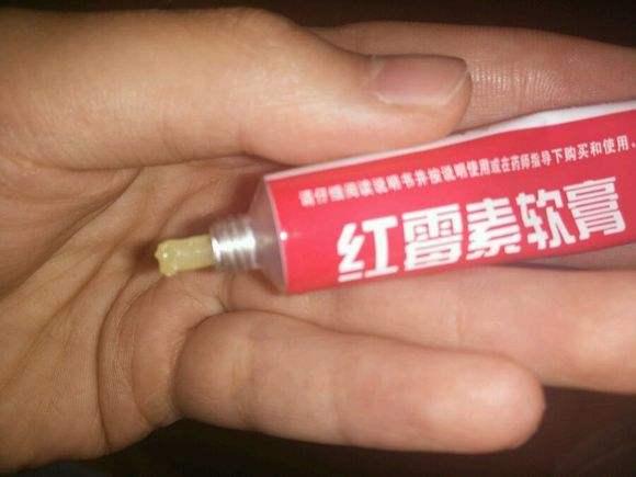 用红霉素软膏涂嘴唇要注意什么吗,红霉素软膏的6大用途
