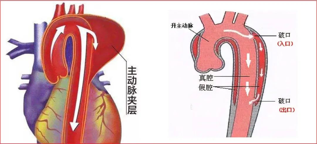 胃痛到晕厥去医院打吊针,胃痛在医院打吊瓶