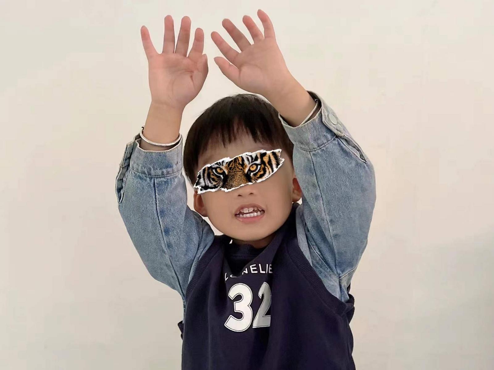 居家隔离急救技能操作,居家隔离脱臼了