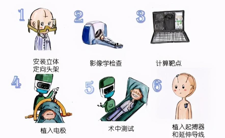 脑科学龙头企业,脑科学龙头股