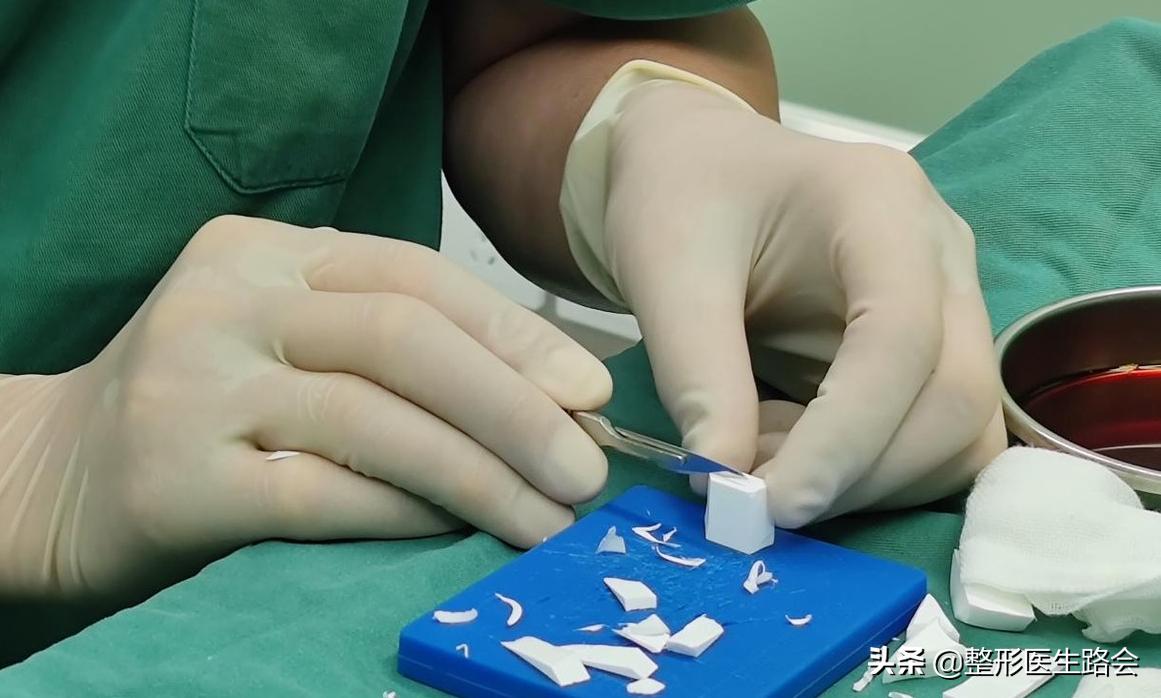 全脸整形记录恢复过程,女孩整形全过程