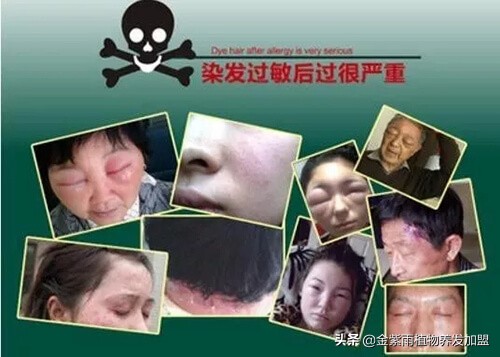 养发馆植物染发剂对身体有害吗,养发染发馆加盟十大品牌