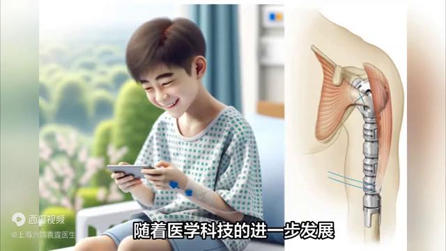 胳膊因肿瘤受损，医学帮你重拾灵活