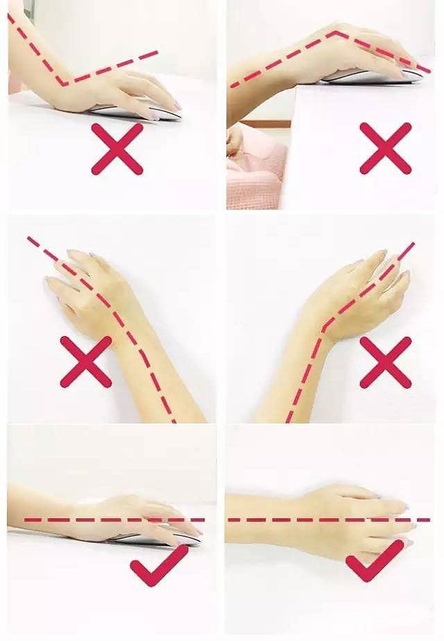 鼠标手腕管综合征挂什么科,白领鼠标手腕管综合征