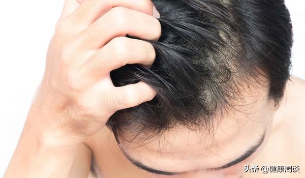 头皮痒有小疙瘩中医,头皮发痒头屑多医生建议