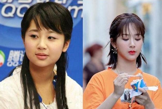 有一种倔强叫做没整容,有种倔强叫不承认整容