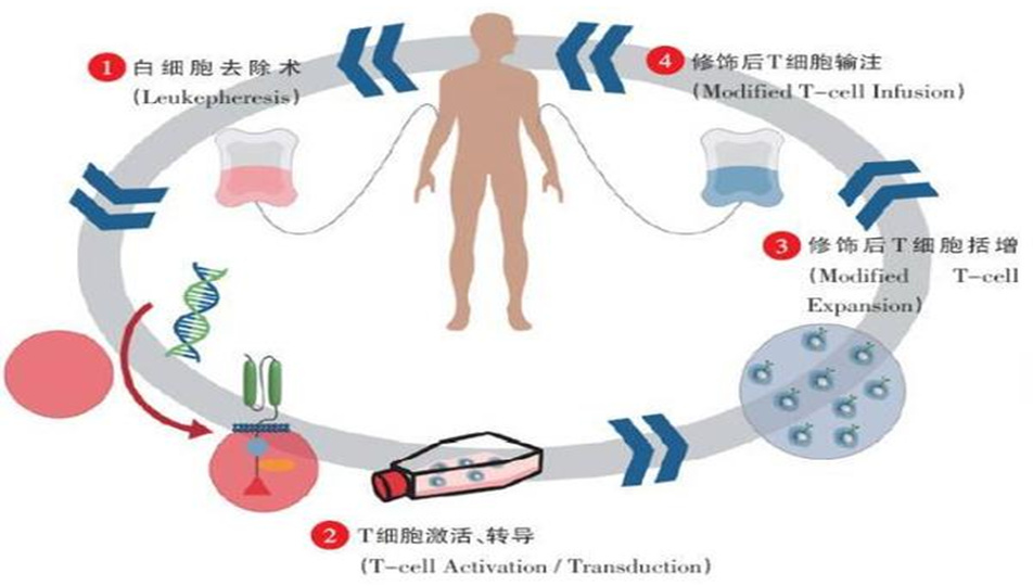儿童alk淋巴瘤化疗可以痊愈吗,car-t治疗晚期淋巴瘤的成功率