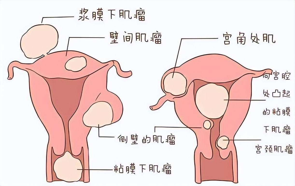 精神一紧张就想上厕所怎么回事,坐车紧张焦虑要上厕所怎么办