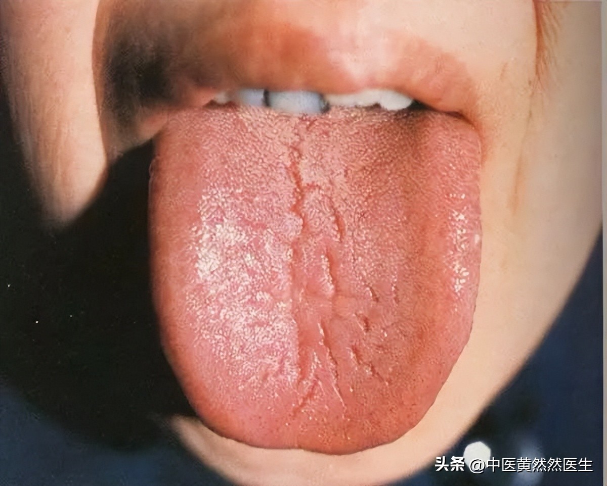 两肋胀跟肝胆湿热有关系吗,两肋胀痛是怎么回事?