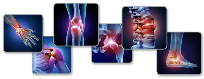 i甲小百科——甲癌术后骨骼健康，可不只是补钙这么简单