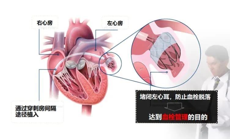 做了艾灸之后有点出血,做了艾灸后少量出血