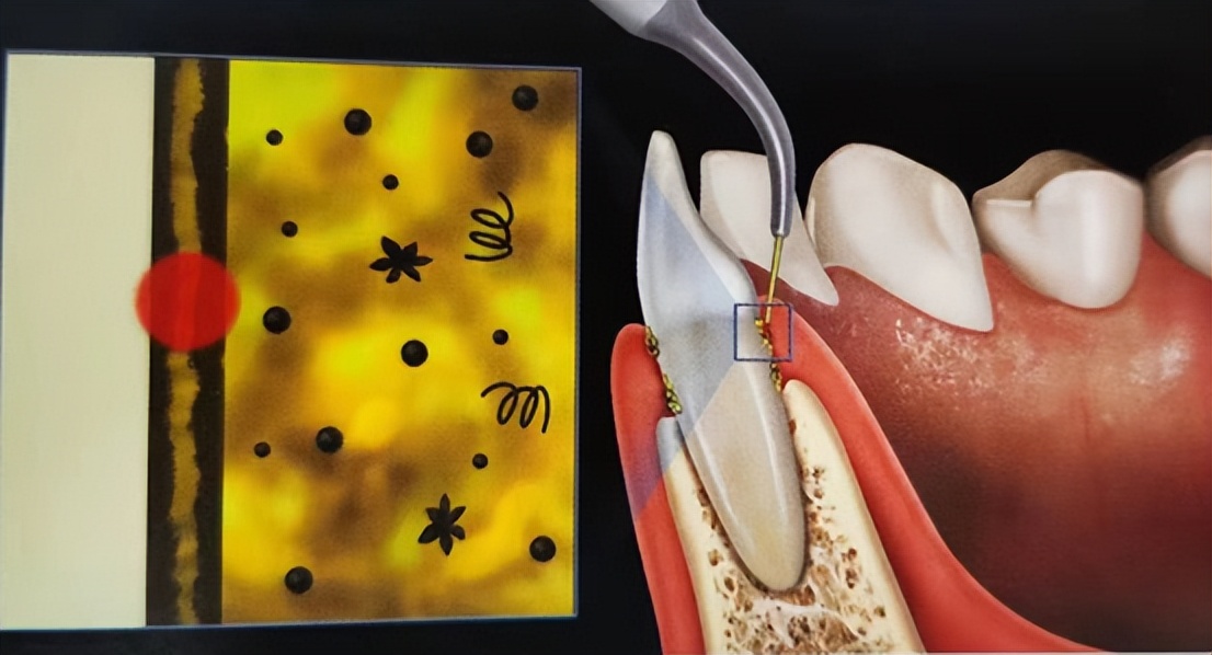 2020徐汇牙防所矫正牙齿费用,徐汇牙防所和静安牙防所哪个好