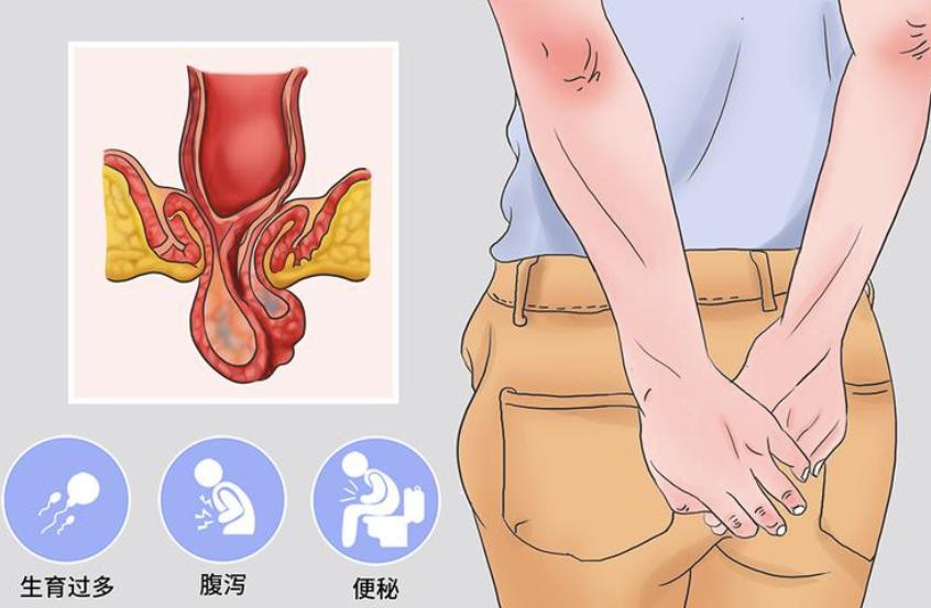 肛门附近的癌症症状,体内有癌大便先知