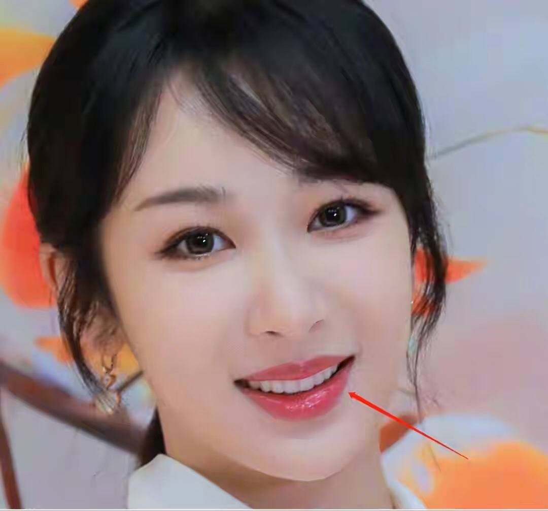 娱乐圈女星龅牙露一颗牙,娱乐圈的假牙女星