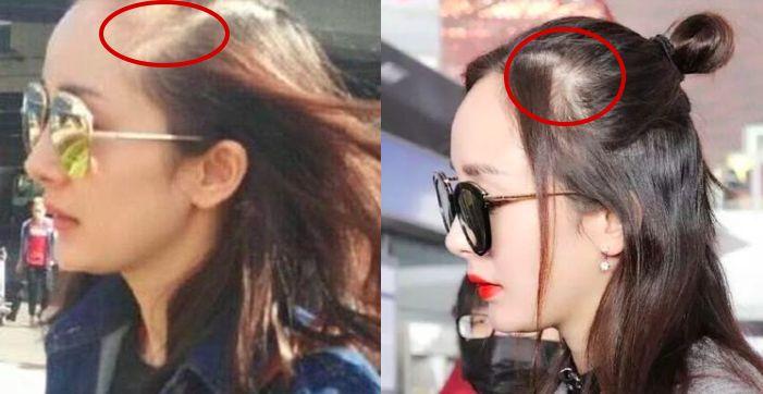 年纪大了为什么头发稀疏了,随着年龄增长头发变稀疏正常吗