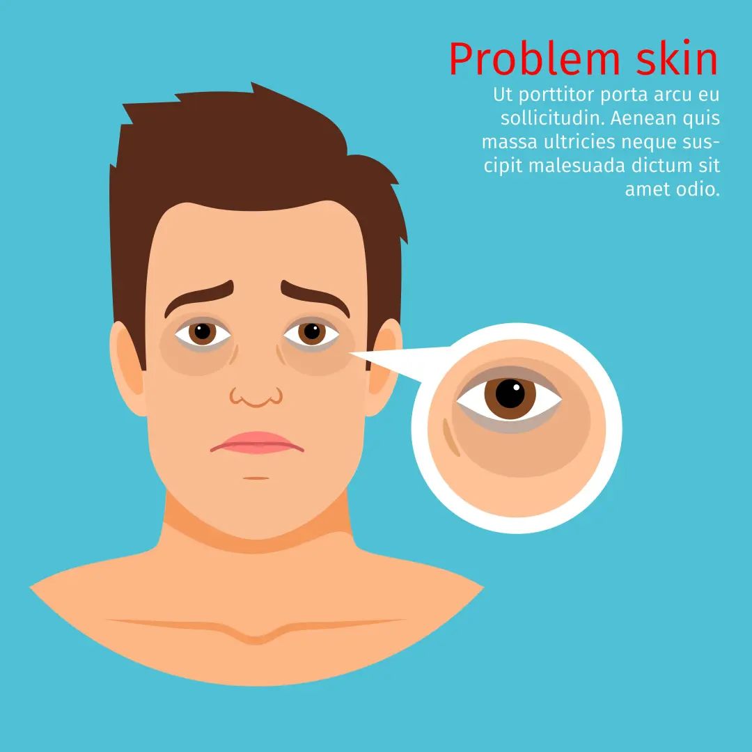 眼霜的哪种成分可以淡化细纹,眼霜怎样用才是最好的效果呢