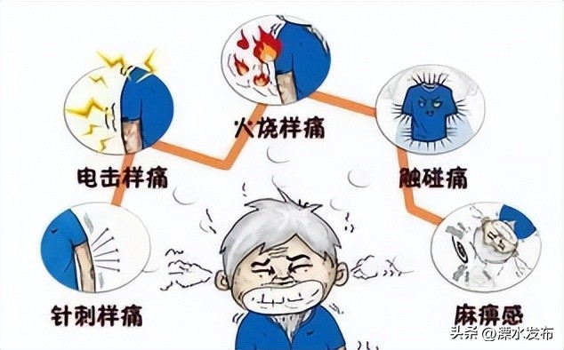 得带状疱疹的人会感染新冠病毒吗,新冠病毒与带状疱疹病毒有关系吗