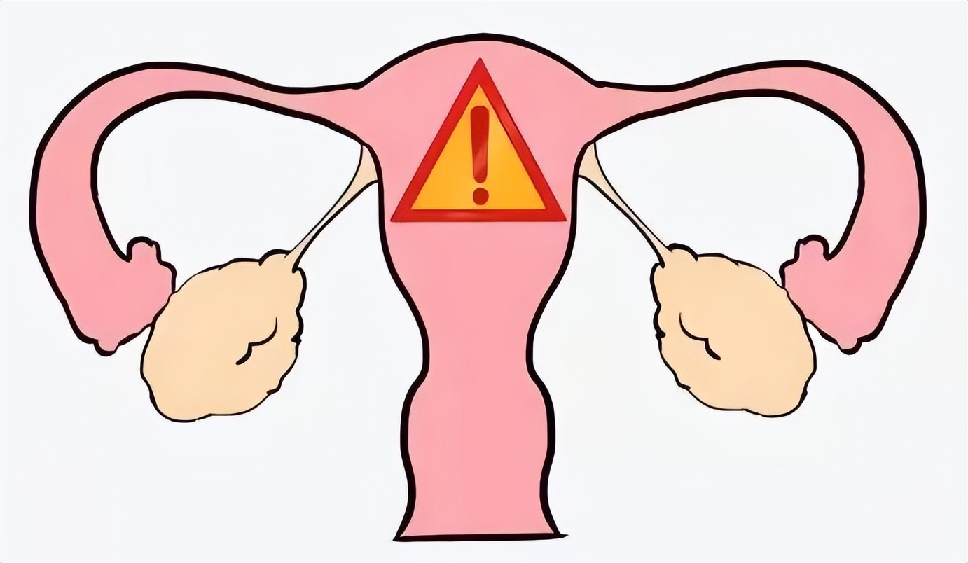 夫妻同房后，女性身体出现这3个症状，要注意了！