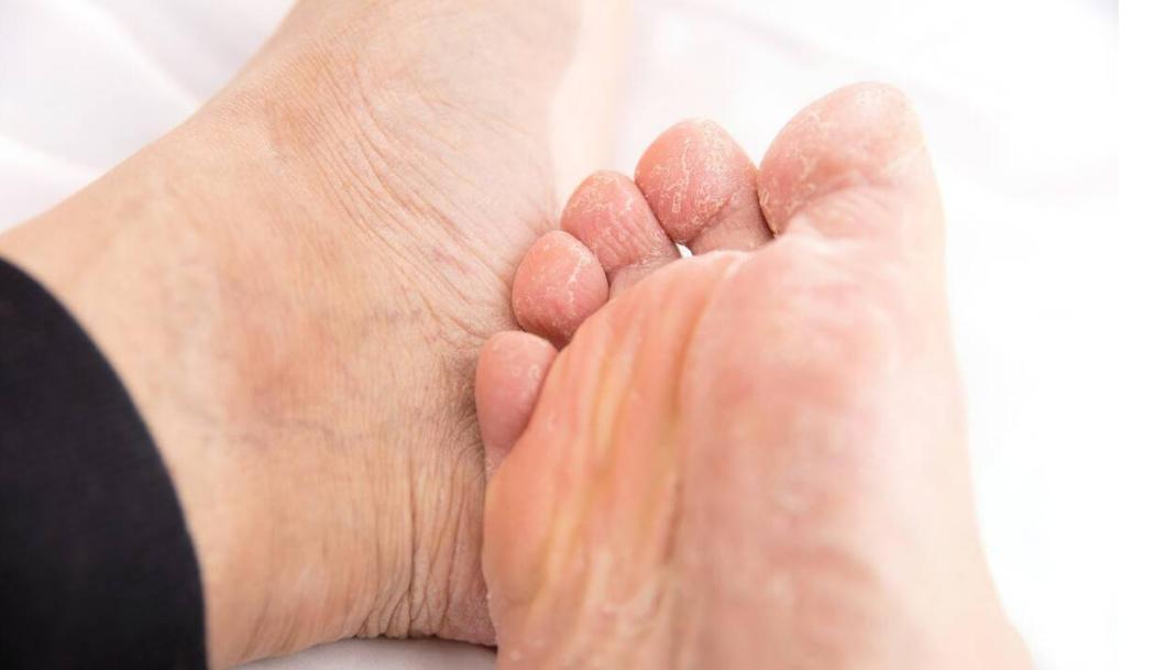 炉甘石洗剂贵的与便宜的有区别吗,炉甘石洗剂世卫推荐