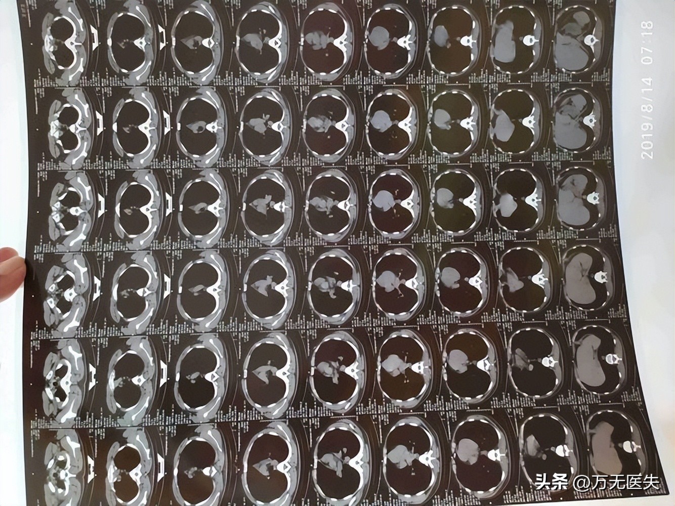 协和有没有转院通知书,协和没有转院通知书是真的吗