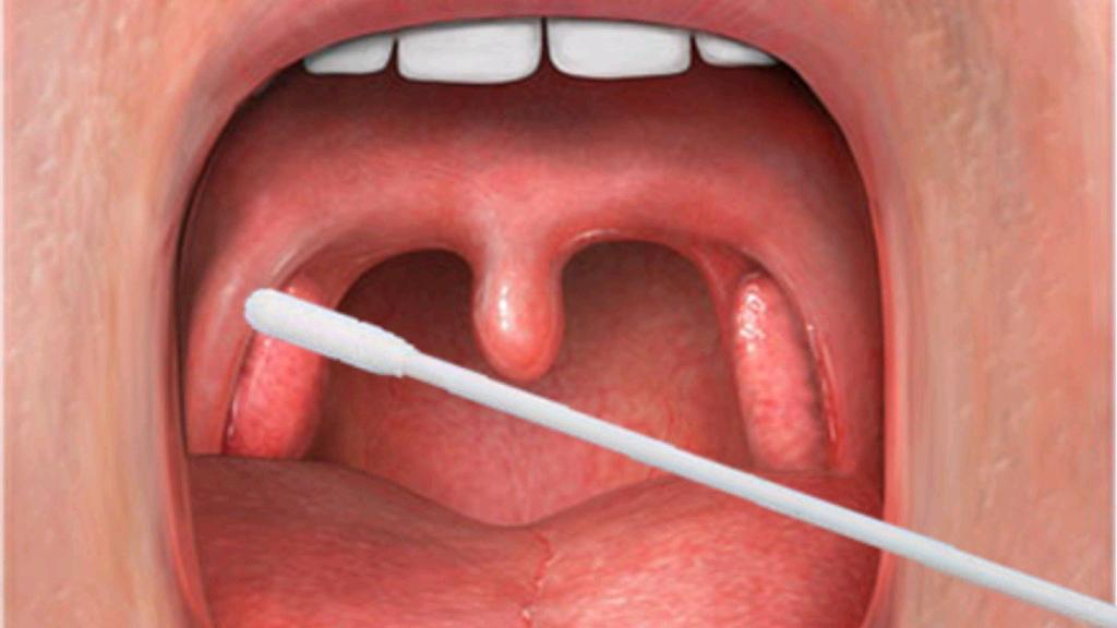 男女之间亲吻有什么害处,男女之间亲吻的禁忌