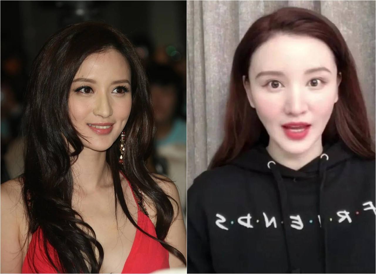 明星脸部僵硬的图片,很多明星脸僵是怎么回事