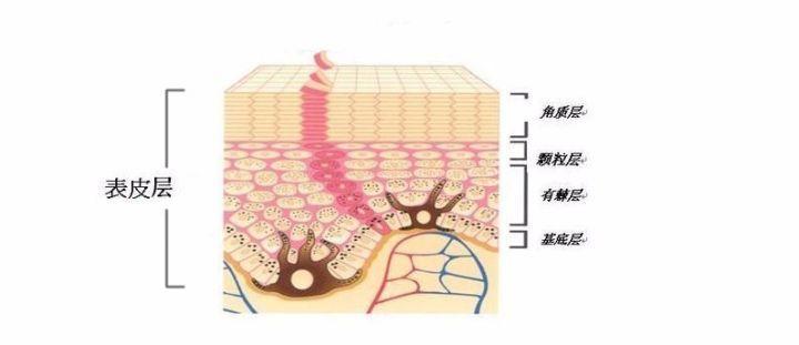 天气冷皮肤有皮屑如何解决,冬天一脱秋裤有大量皮屑怎么办