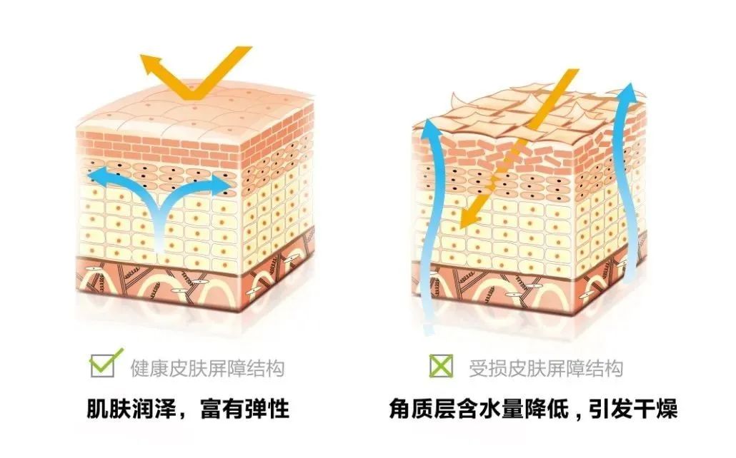 皮肤起皮用什么护肤品角鲨烷 (角鲨烷护肤效果好吗)