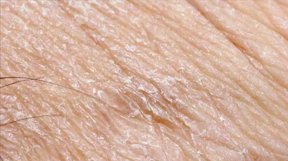 为什么用完洗面奶脸部泛红起皮,为什么用完洗面奶后脸更黑了