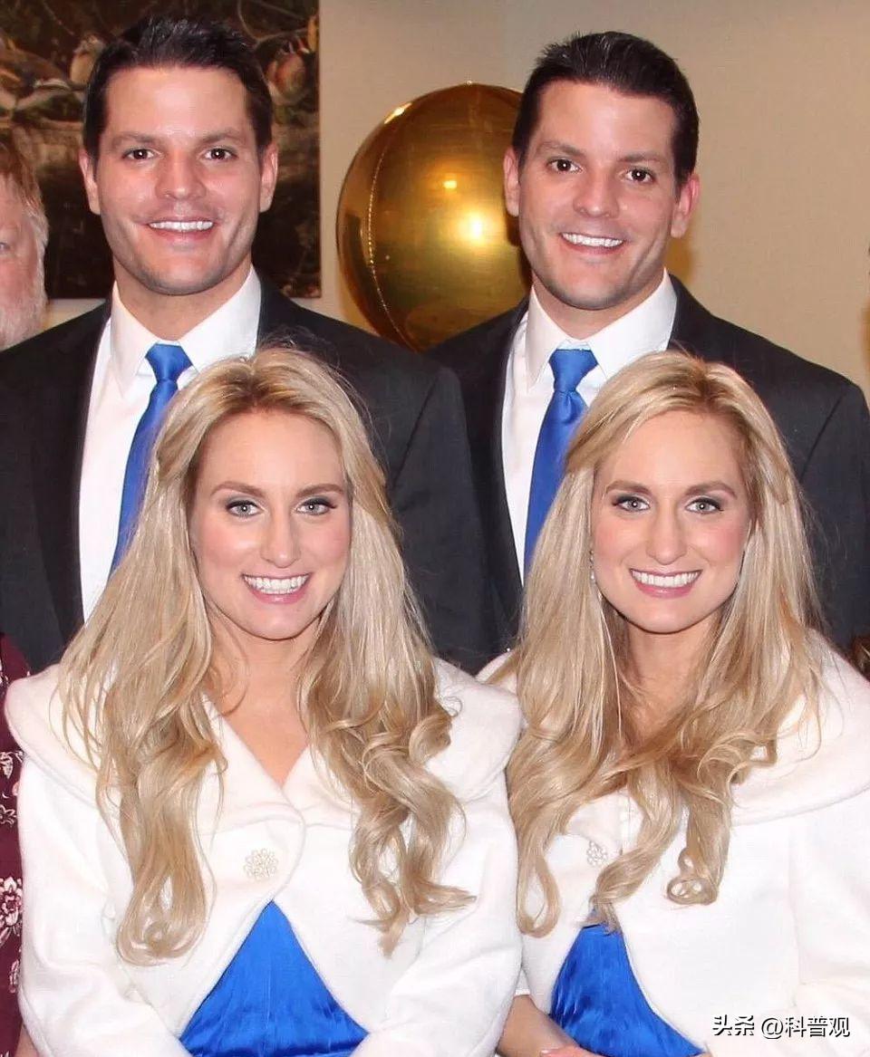 连体人一方死亡怎么办？妹妹去世后，连体姐姐被迫跟遗骸共同生活