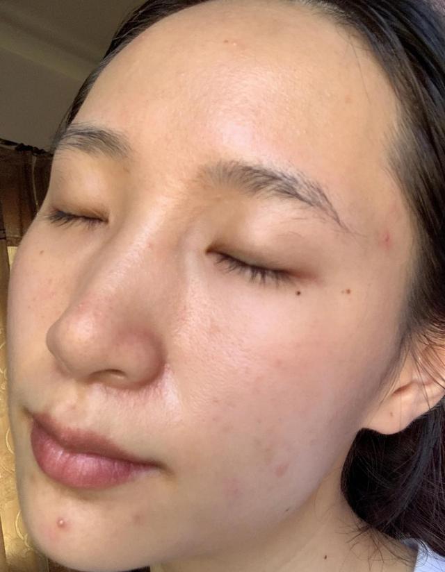 连续三天不洗脸起皮,连续3天不洗脸会怎么样