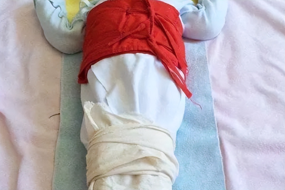 父母都不是o型腿孩子会是吗,家长有o型腿会遗传给宝宝不