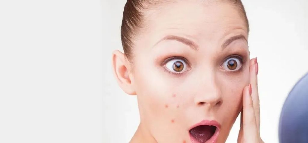 自检一下，你的皮肤受损到什么地步了