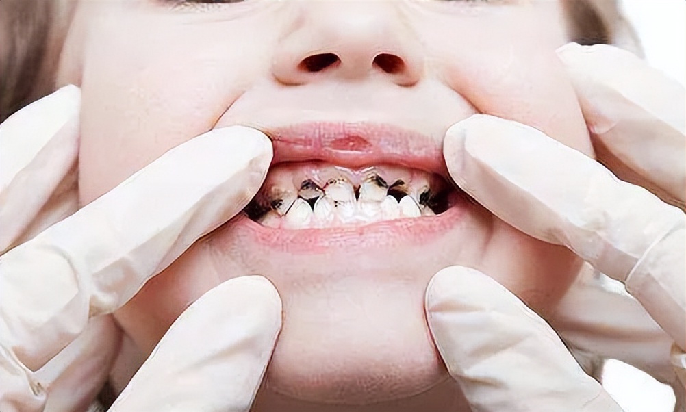 牙科恐惧症如何缓解,牙科焦虑症和牙科畏惧症