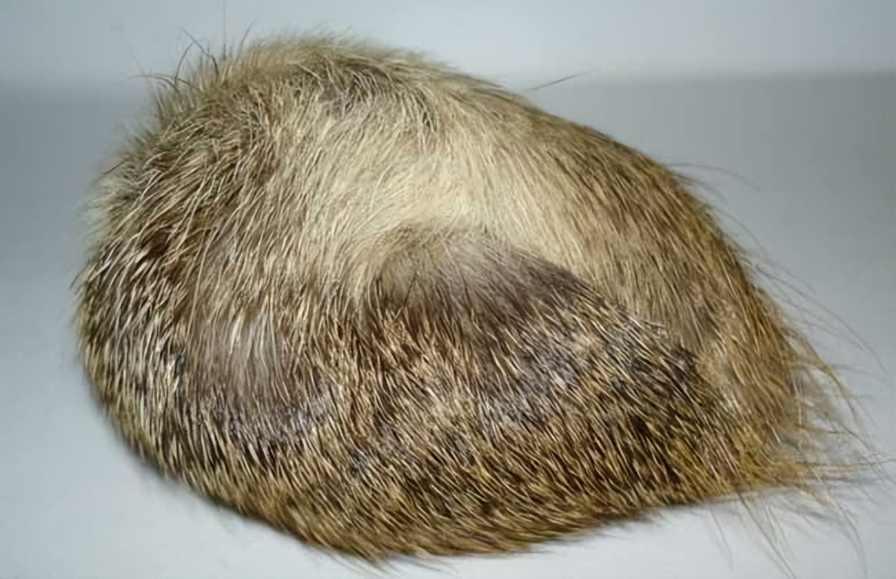 消瘤丸治子宫肌瘤怎么样,肌瘤内消丸配方