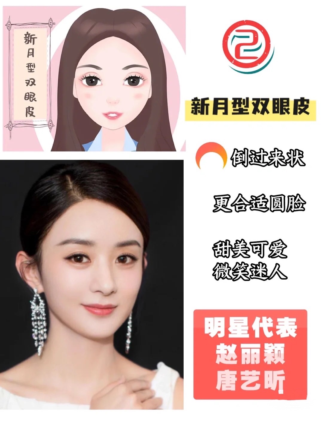 整形科普知识修复双眼皮,双眼皮整形有哪些常见方法