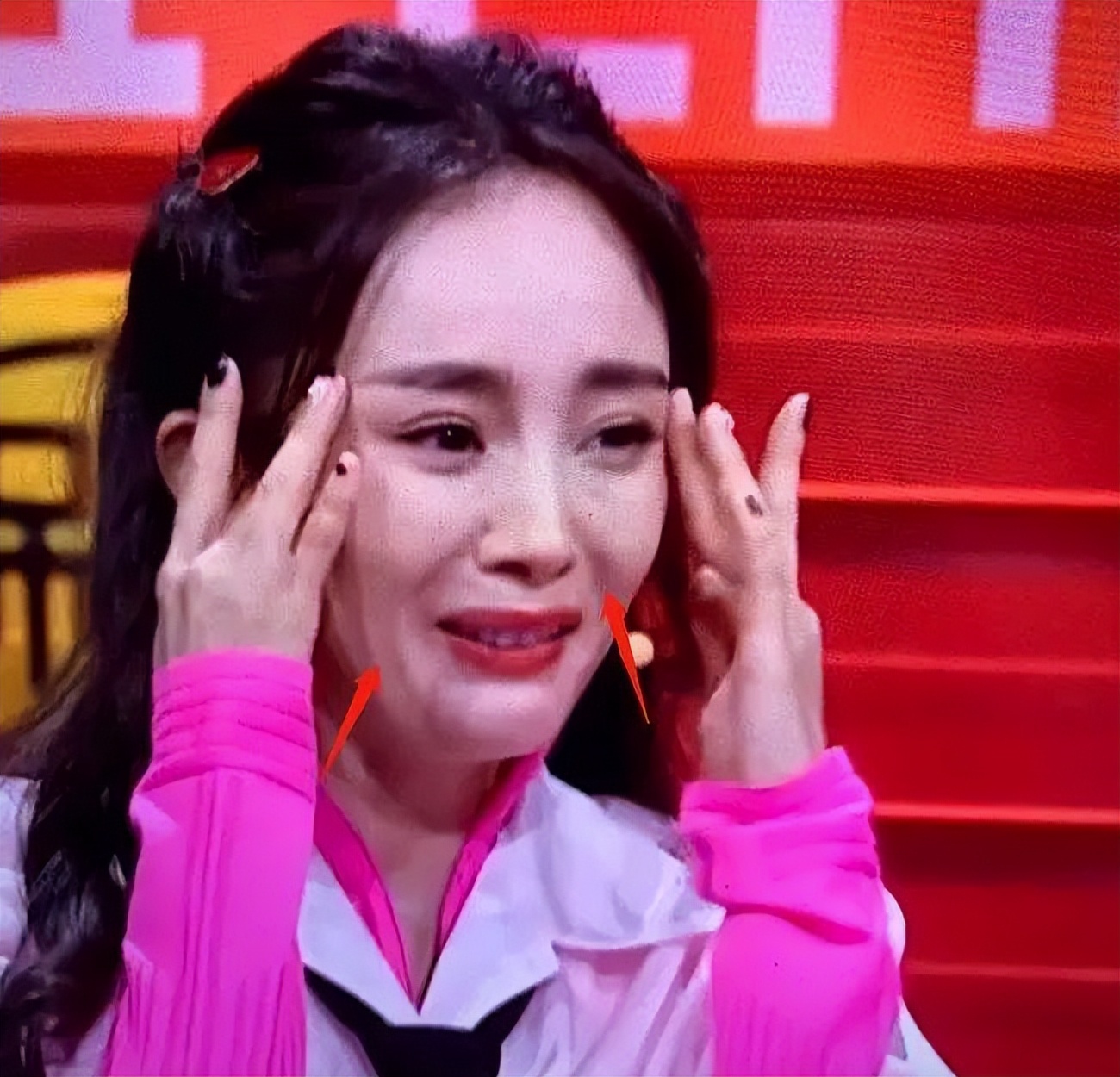 哪些明星整容后遗症越来越严重,整容明星后遗症对比图片