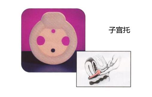 只有小腹痛没有流血是流产吗,从见红到自然流产都没有腹痛