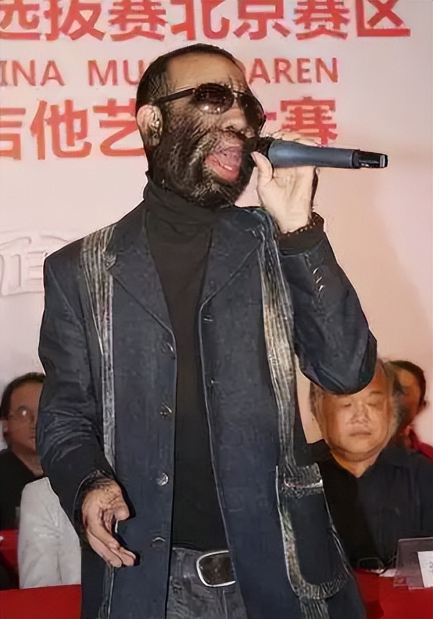 当年轰动一时的“毛孩”：42岁娶90后娇妻，生下一子未遗传长毛