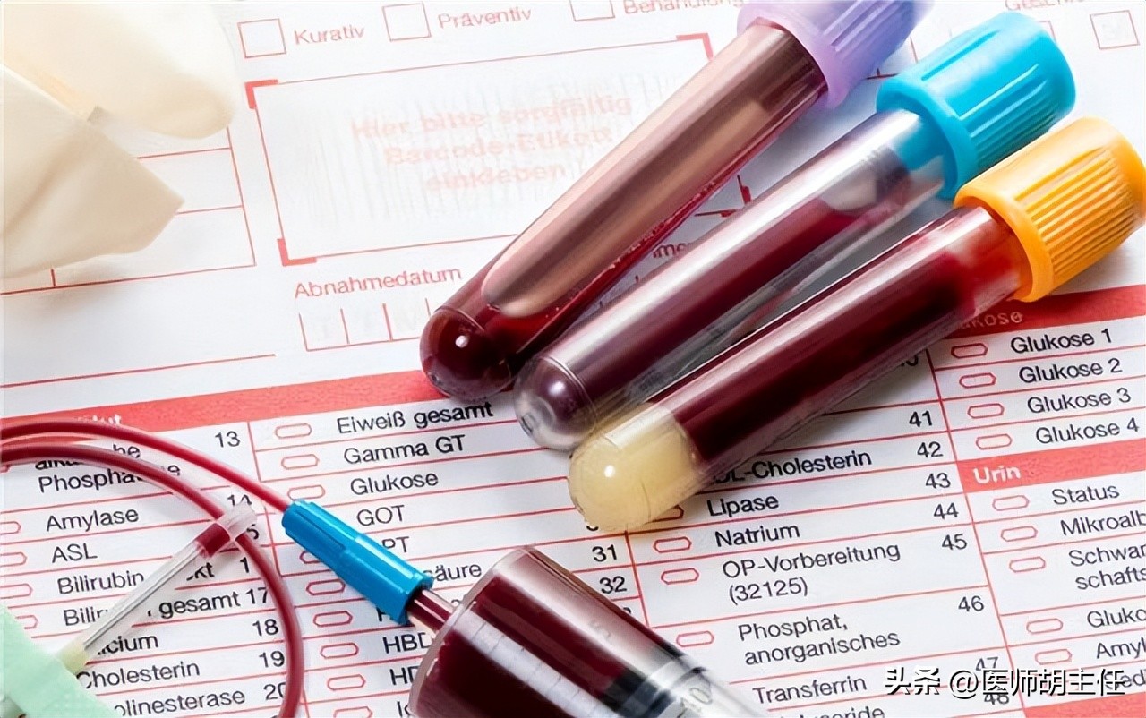 体检发现胆红素高是怎么回事,体检胆红素高怎么快速降下来