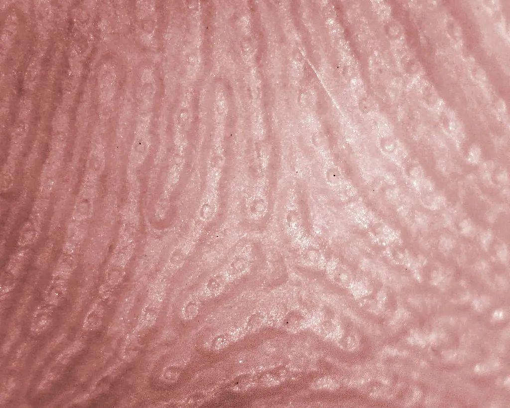 天生没有指纹的人是怎么回事,天生无指纹的人