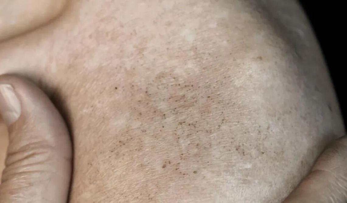 女性*处私**发黑，是因为“经历”太多了？原因可能有2个，别想歪了