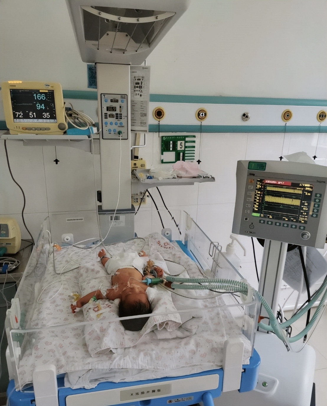 新生儿呼吸衰竭病例分析题,新生儿呼吸衰竭是什么原因引起的