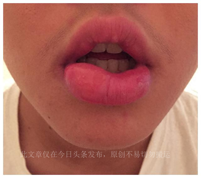 孩子总爱咬指甲吃点儿什么药,孩子总爱咬手指甲